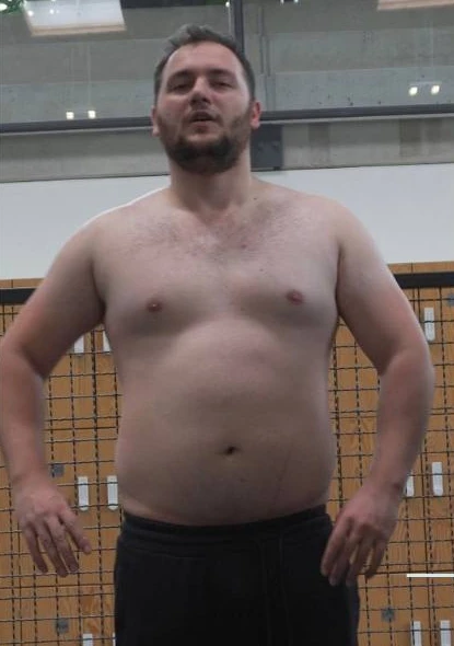 Kunde 1 vor dem Personal Training - Körper-Transformation