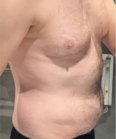 Kunde 10 vor dem Personal Training - Körper-Transformation