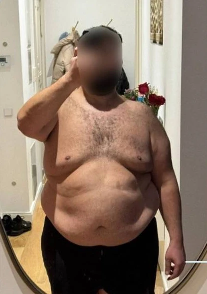 Kunde 3 vor dem Personal Training - Körper-Transformation