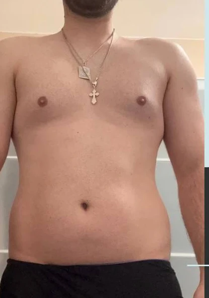 Kunde 4 vor dem Personal Training - Körper-Transformation