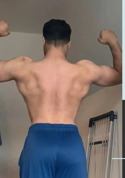 Kunde 7 vor dem Personal Training - Körper-Transformation