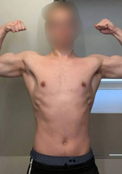 Kunde 8 vor dem Personal Training - Körper-Transformation